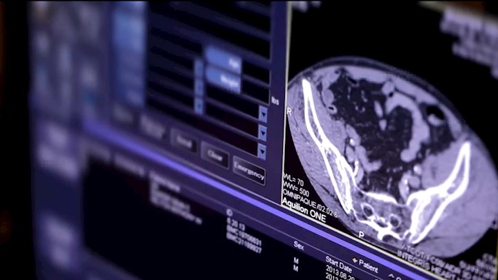 Schedule Your $50 HeartScan