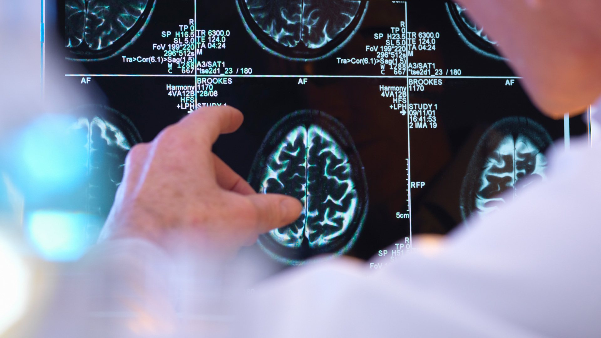 Neurology