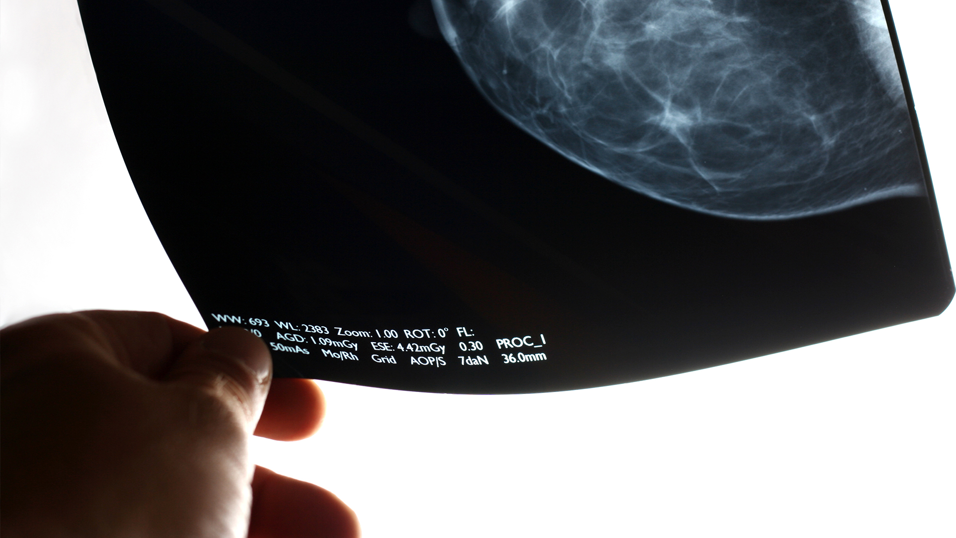 Schedule Your Mammogram