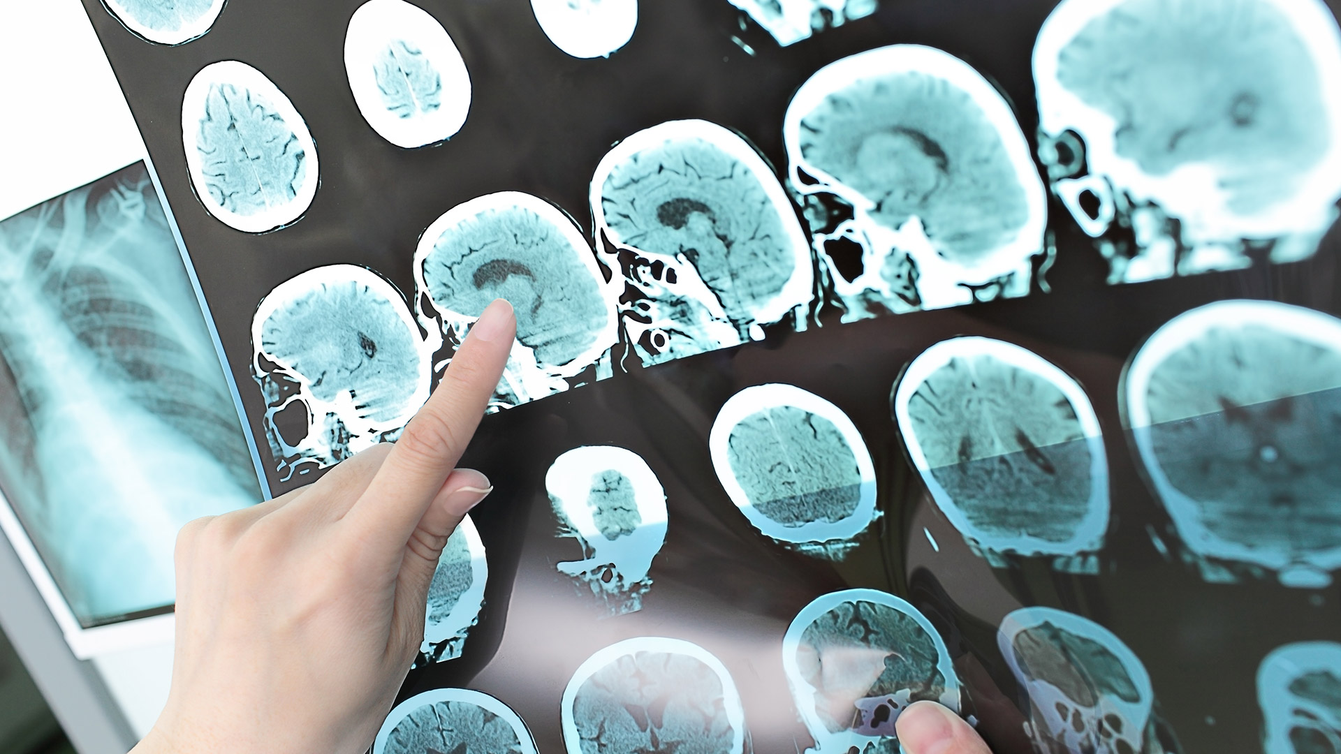 Neurosurgery