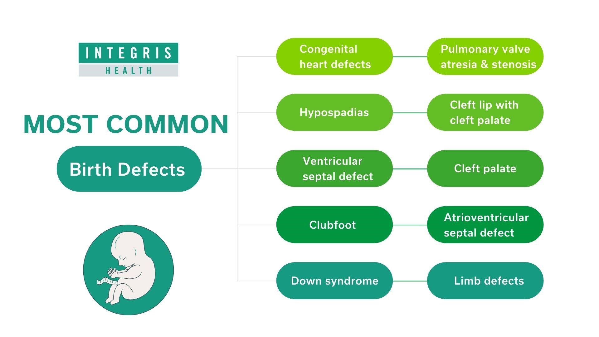 Most Common Birth Defects