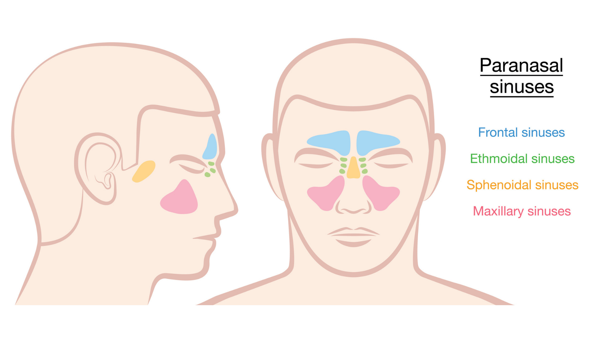 What are the different types of sinuses?