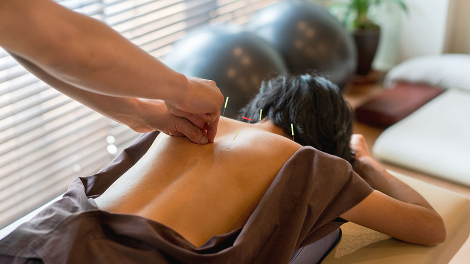 Is Acupuncture Right for You?