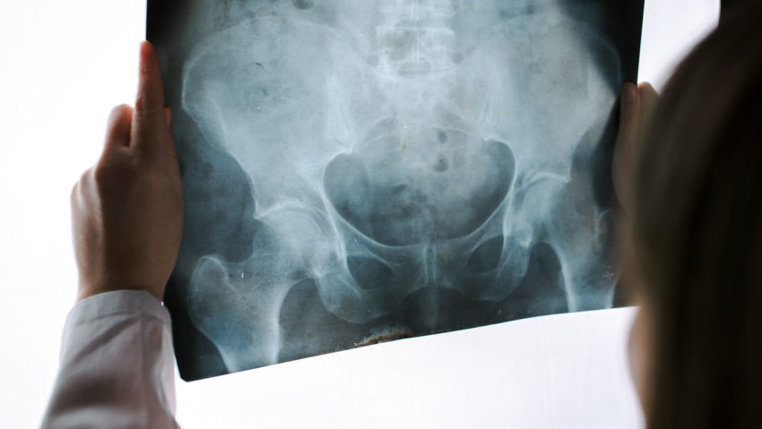 pelvic health