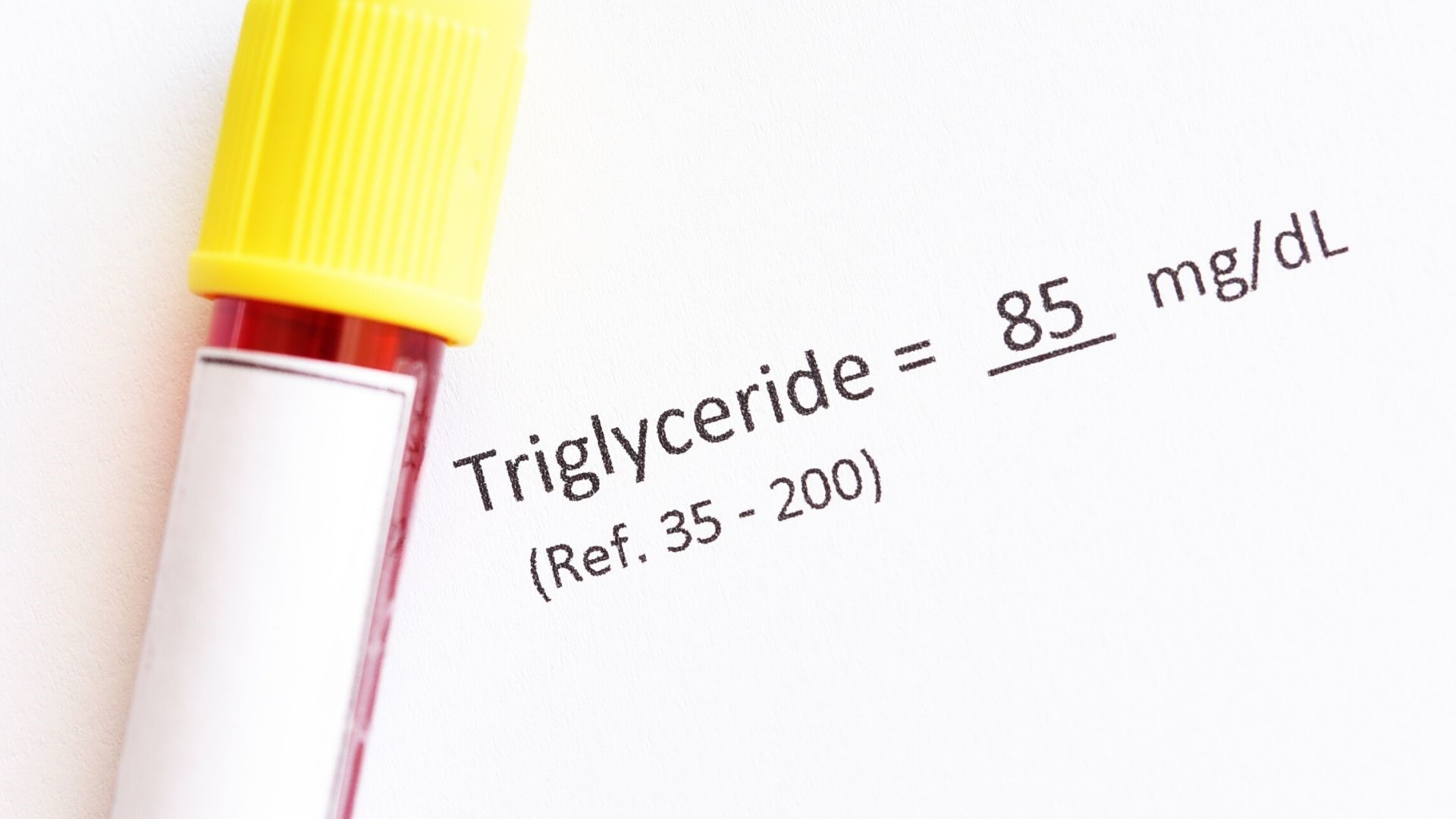 What Are Triglycerides and Why Is It Important to Keep Your Levels Low?