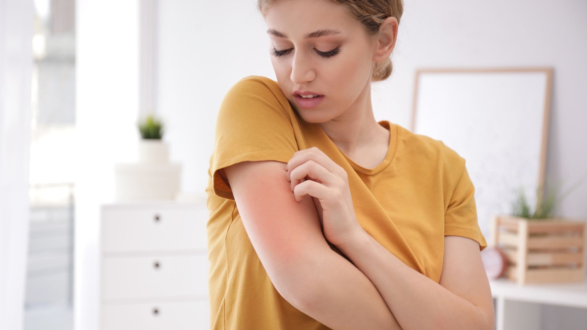 Managing Dry Skin During the Winter