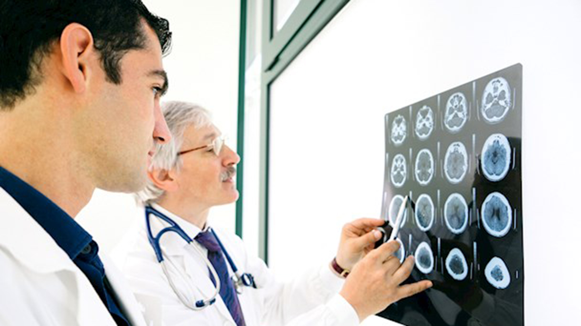 Your Stroke Questions, Answered.